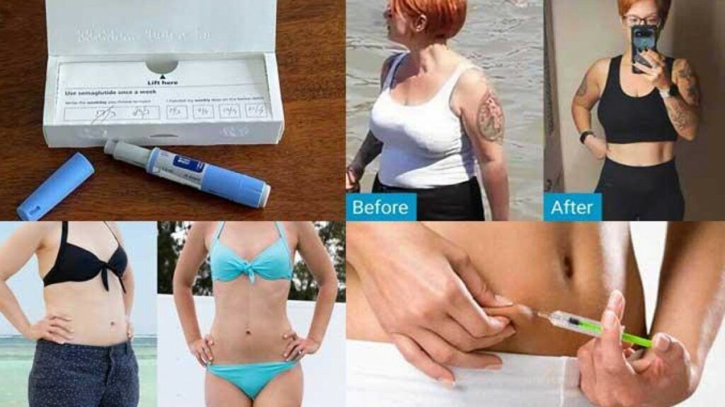Ozempic devine disponibil în versiuni generice în mai multe țări, reducând costurile și extinzând accesul la tratamente Medicamentul Ozempic, utilizat pentru tratamentul diabetului de tip 2 și controlul greutății, va fi disponibil în versiuni generice în mai multe țări începând cu anul 2026