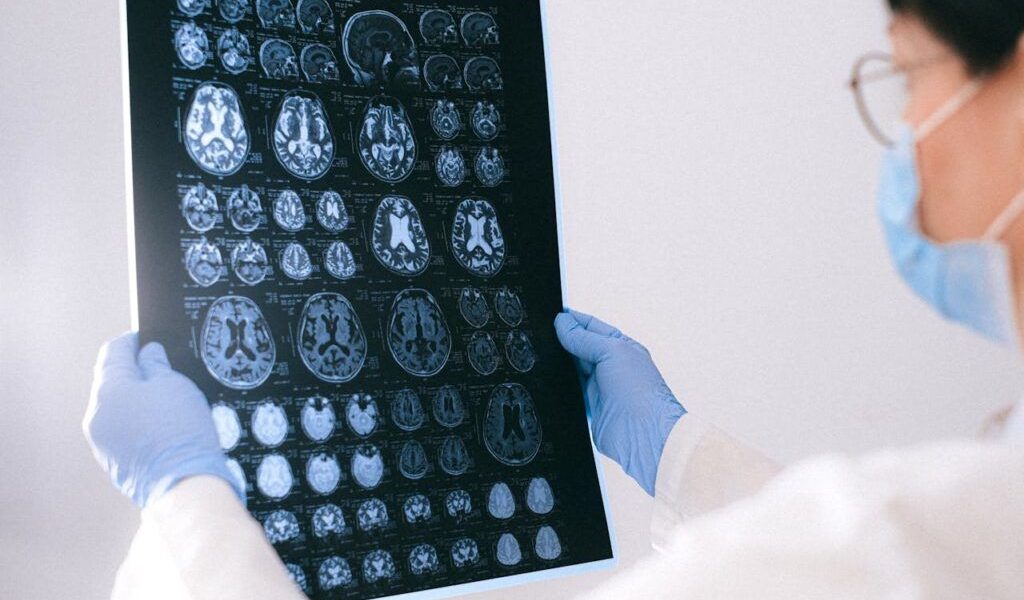 Un neurolog avertizează: Primul semn al declinului cognitiv, fără legătură cu memoria