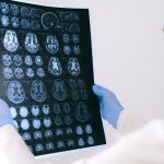 Un neurolog avertizează: Primul semn al declinului cognitiv, fără legătură cu memoria