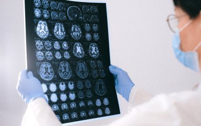 Un neurolog avertizează: Primul semn al declinului cognitiv, fără legătură cu memoria