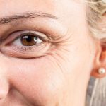 Riduri: Semnele timpului sau amprentele unei vieți? Analiza vieții trăite