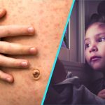 Rujeolă, gripă, vaccinare: Dr. Alexiu, despre drama copiilor din România