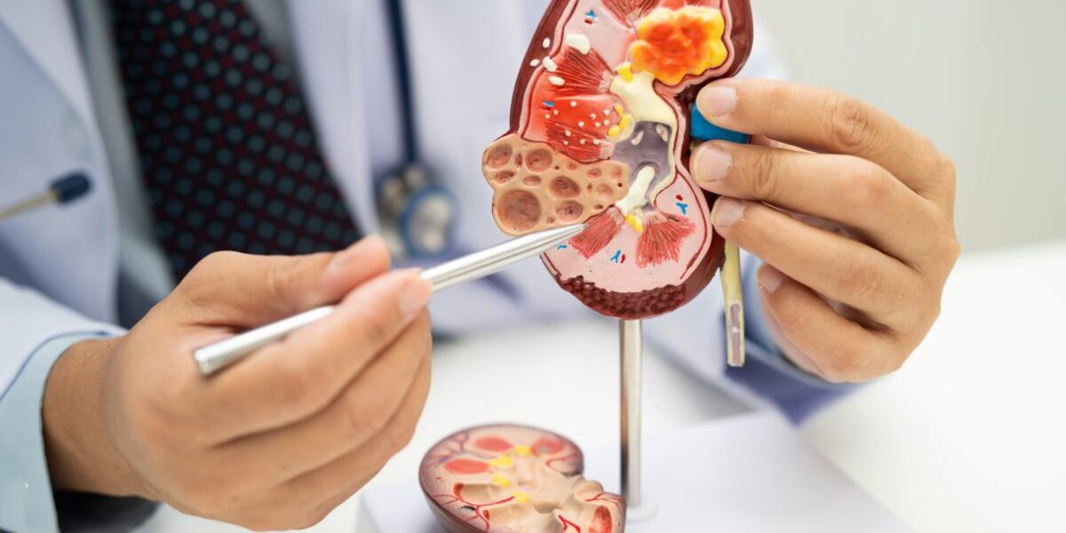 Acid uric vs. creatinină: Ce arată analizele despre rinichi