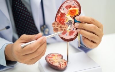 Acid uric vs. creatinină: Ce arată analizele despre rinichi
