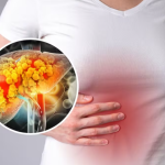 Moartea lui Thierry Ardisson: Cancerul de ficat, explozie până în 2050. Ce semne contează?