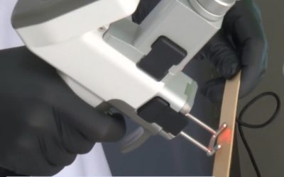 Perfecțiune la preț de chin: Cum forțează esteticienii limitele în România