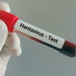 Hantavirusul ucide pe o navă de croazieră: Adevărul despre riscurile din România