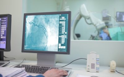 Probleme cu inima: când coronarografia e singura soluție, nu doar control