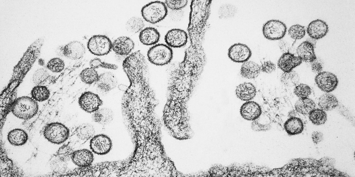 Hantavirus ucigător pe un vas de croazieră în Atlantic