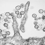 Hantavirus ucigător pe un vas de croazieră în Atlantic