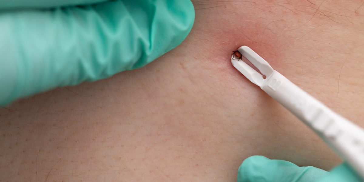 Alpha-Gal: Boala mortală declanșată de căpușă. Medici explicați