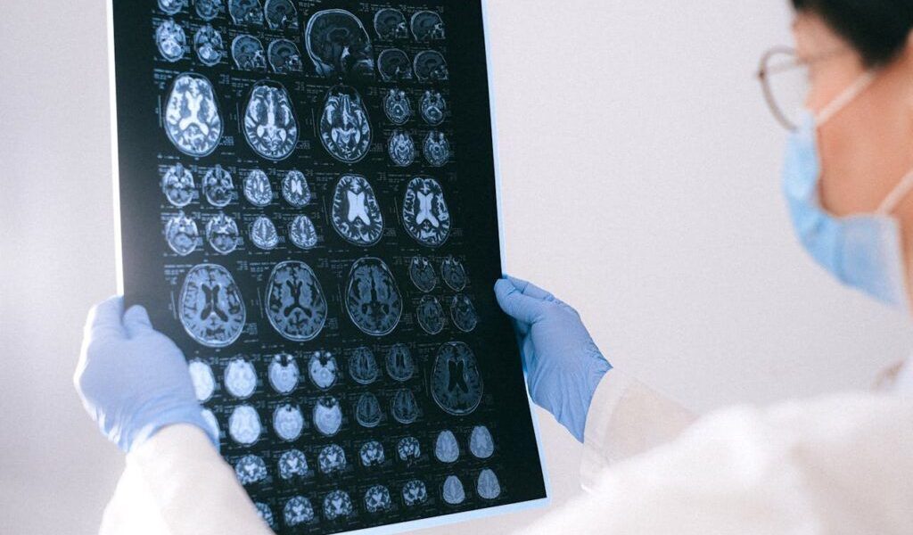Star de Hollywood, diagnosticat cu Alzheimer după un Oscar