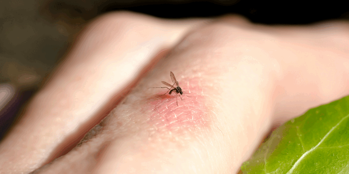 Viespi și țânțari: Scăpați de ei natural, sfaturi de experți