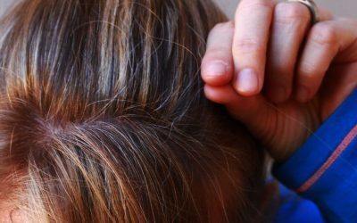 Usturoiul: Miracol natural contra firelor gri