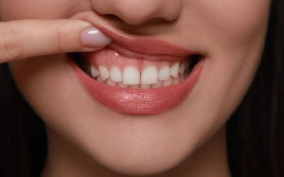 Semn în gură: pericol pentru sănătate, nu doar estetică