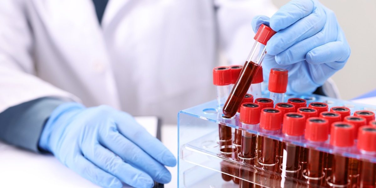 Descoperire medicală: Noua grupă sanguină rezolvă misterul de 50 de ani