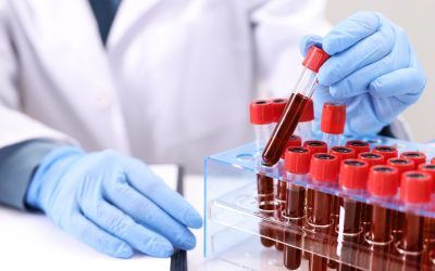Descoperire medicală: Noua grupă sanguină rezolvă misterul de 50 de ani