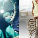 Femei își rup coastele pentru siluetă, experții îngrijorați