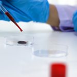 Ciuma din Rusia: boala misterioasă și pericolul real