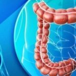 Cancer rectal: 49 de pacienți vindecați fără operație